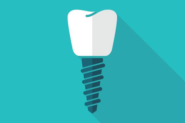 What To Expect When Getting A Dental Implant To Replace A Missing Tooth